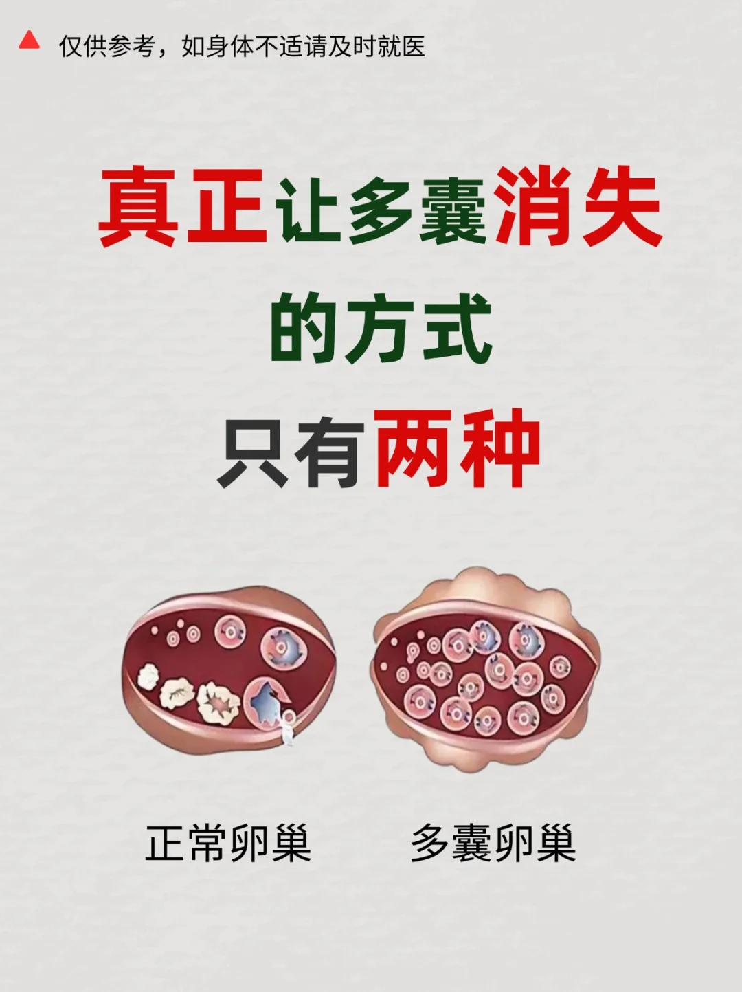 真正能让多囊消失的方式，只有这两种,孕宝代孕微信